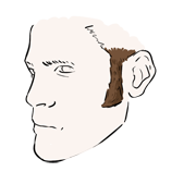 sideburns
