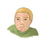 measles