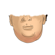 mumps