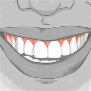 gums